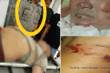 Komnas HAM rekomendasikan penanganan kasus dugaan penyiksaan di Sulsel berujung kematian seorang warga pada 24 Juli 2019 lalu.