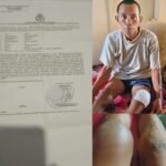 Seorang pria berusia 44 tahun bernama Arifin, warga Monro-Monro Kecamatan Binamu, Kabupaten Jeneponto jadi korban pengeroyokan, Mei 2025. (R35/HO)