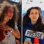 Jurnalis Bayan Abu Sultan terluka ketika pendudukan Israel mengebom resor "Al-Baqa" di pantai Gaza.