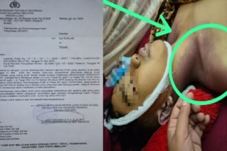 Kasus dugaan penganiayaan anak di Luwu, polisi dinilai lamban bertindak, (19/8/2025).
