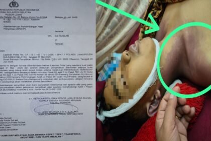 Kasus dugaan penganiayaan anak di Luwu, polisi dinilai lamban bertindak, (19/8/2025).
