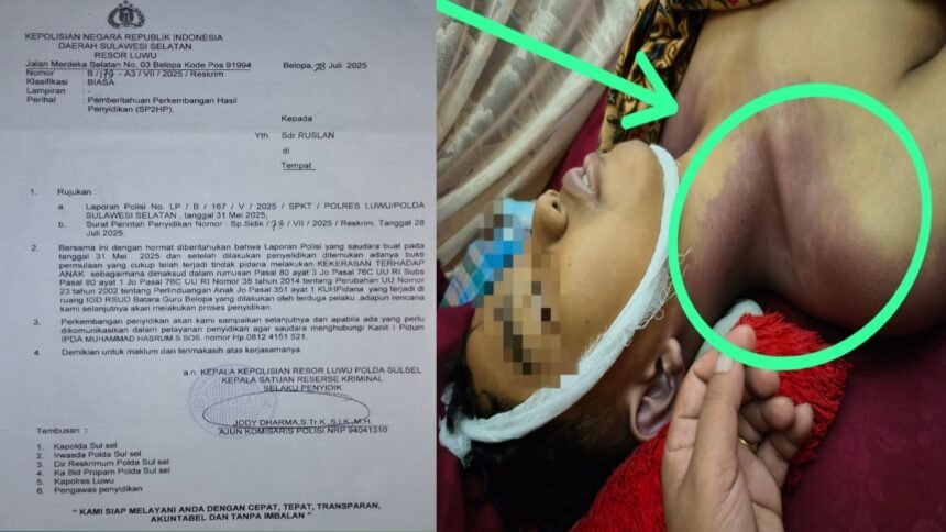 Kasus dugaan penganiayaan anak di Luwu, polisi dinilai lamban bertindak, (19/8/2025).