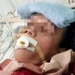 Pasien pendarahan otak di RS Fakfak terbaring kritis menunggu alat operasi yang belum tersedia, (16/11/2025).