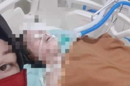 Korban HA dirawat intensif di ruang perawatan rumah sakit di Makassar, Selasa (23/2/2026), usai mengalami luka bakar serius dalam peristiwa yang tengah diselidiki aparat kepolisian.