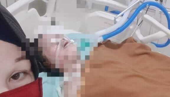 Korban HA dirawat intensif di ruang perawatan rumah sakit di Makassar, Selasa (23/2/2026), usai mengalami luka bakar serius dalam peristiwa yang tengah diselidiki aparat kepolisian.